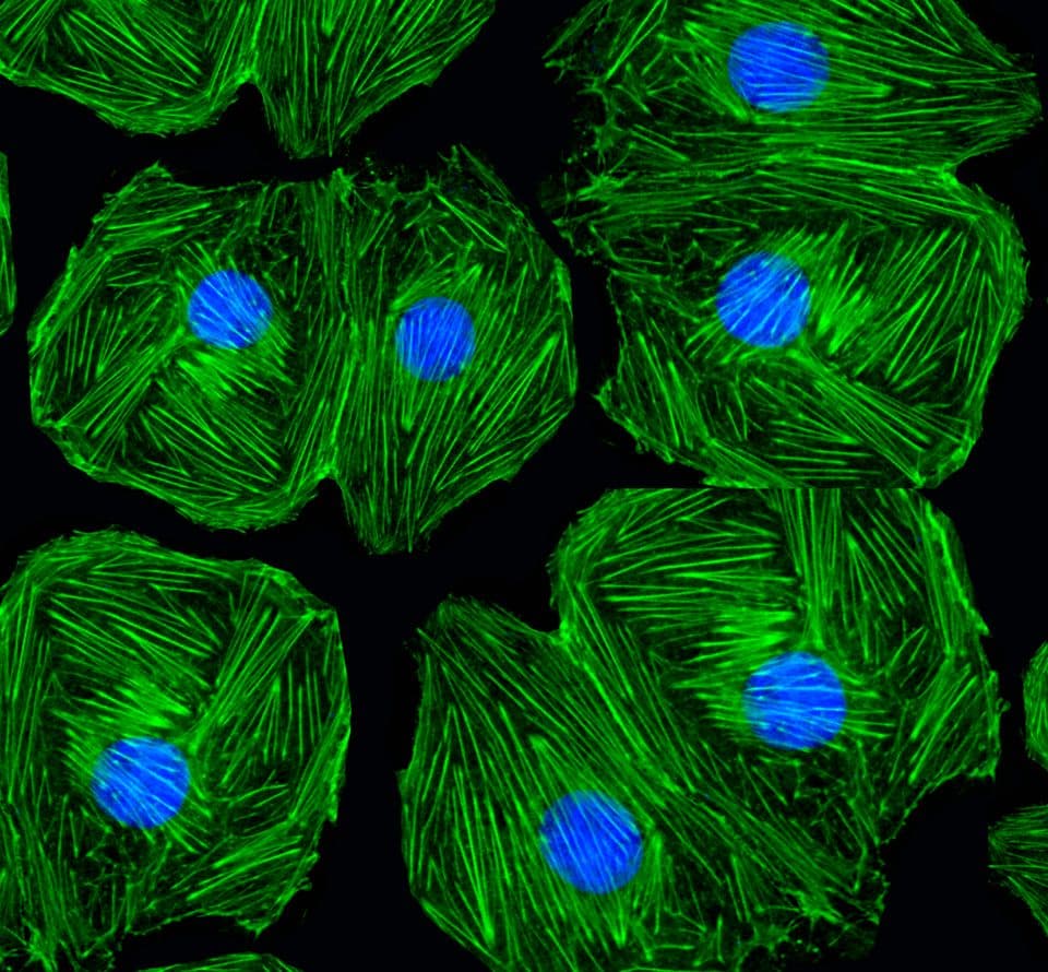 fluorescence microscopy showing stained actin staining of cells