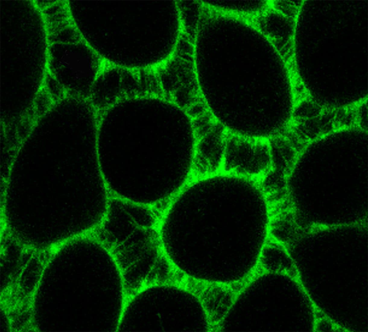 microscopy of cells imaged with plasma membrane markers