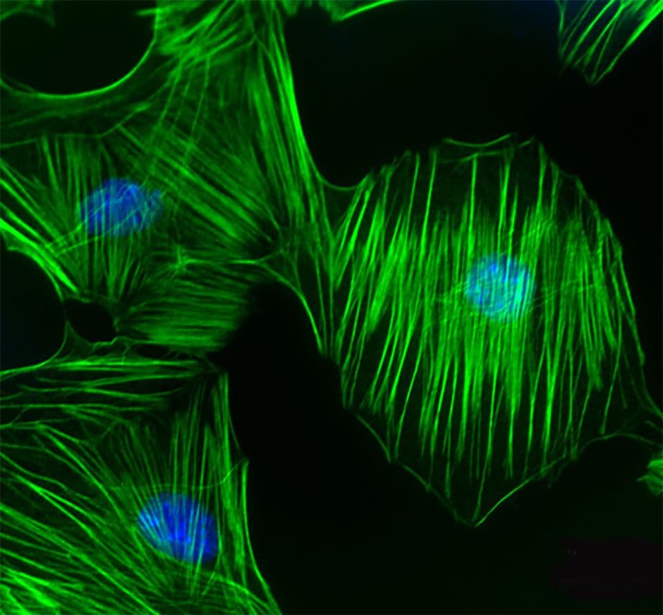 fluorescence microscopy showing stained cytoskeletal filaments and nuclei