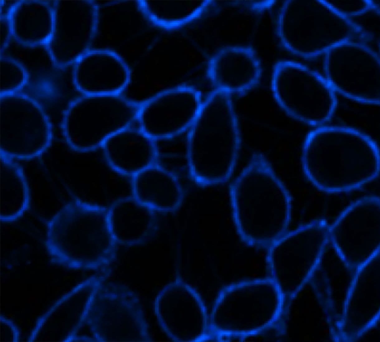 microscopy of cells imaged with plasma membrane markers