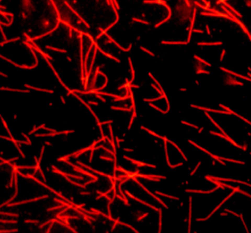fluorescence microscopy of fluorescent tubulin