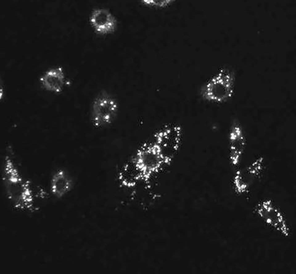 microscopy of cells labeled with Lipibright lipid droplet probes