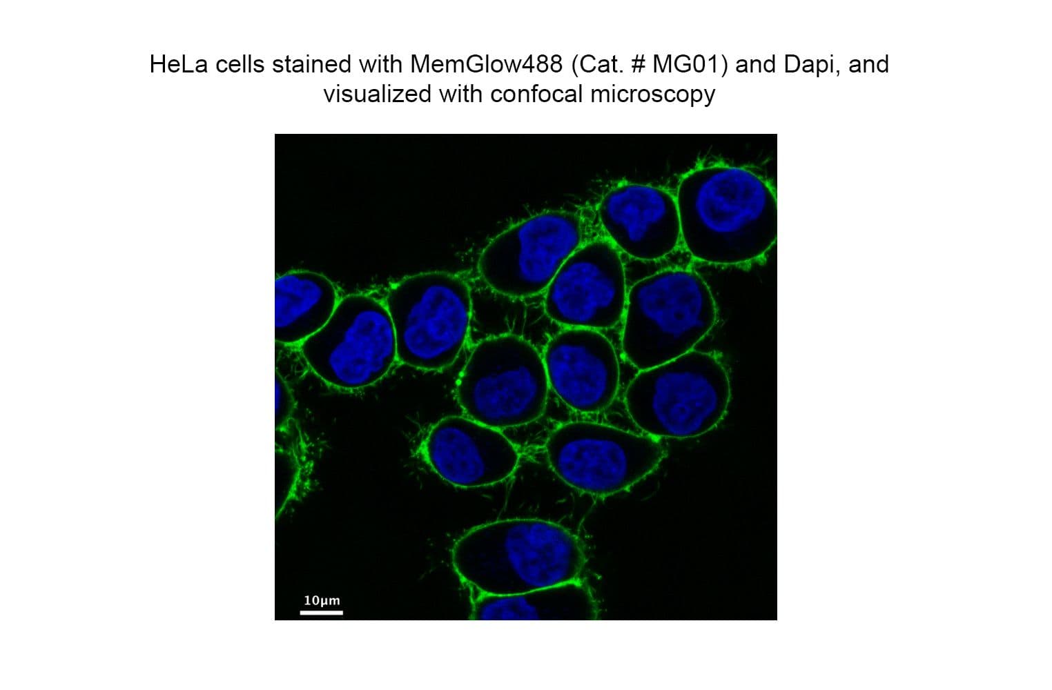 Memglow plasmamembrane stained HeLa cells MG01