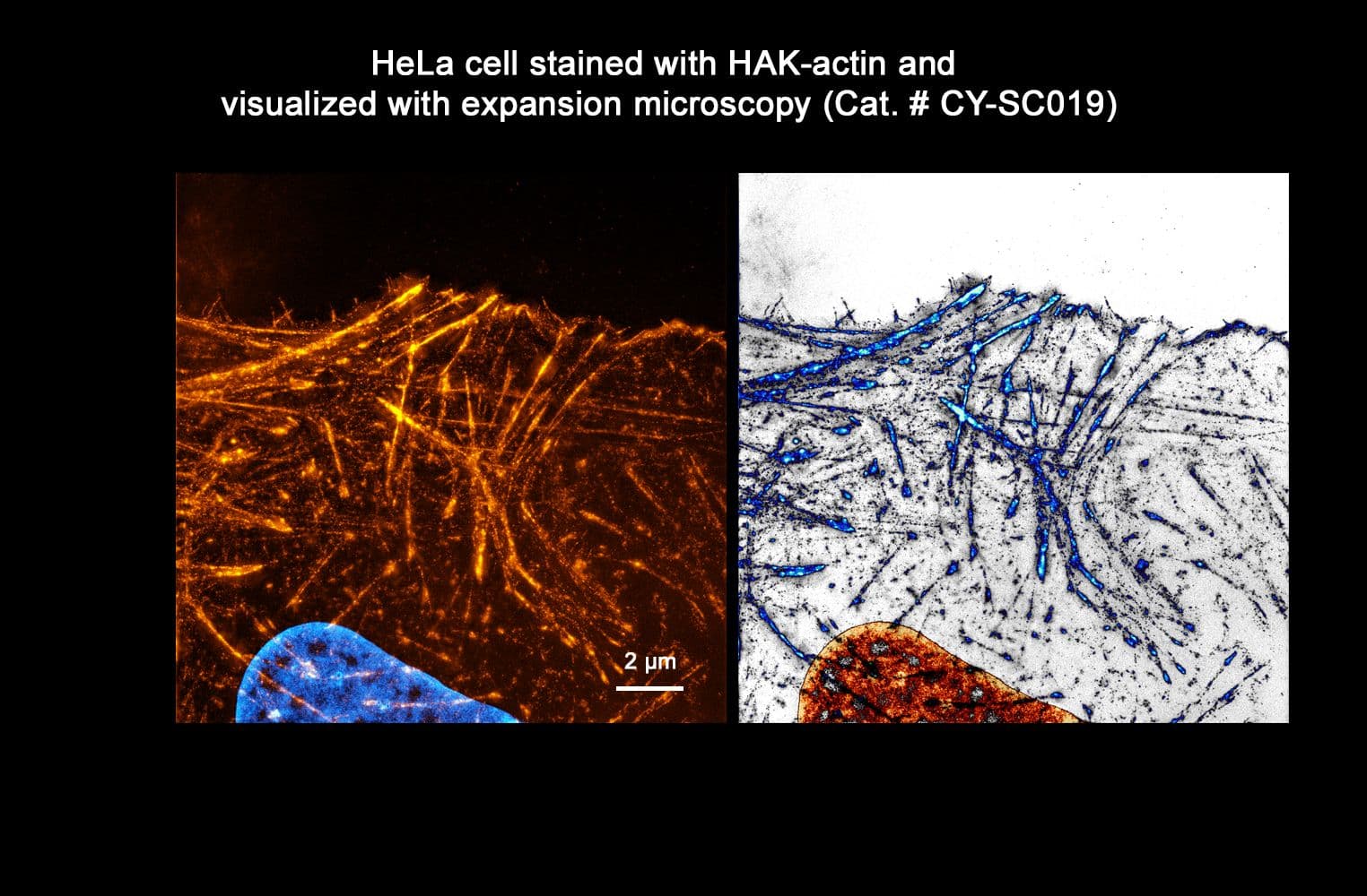 HeLa cell staining with HAK-actin and visualized with expansion microscopy
